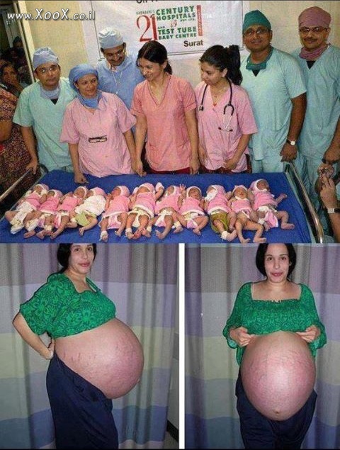 תמונת לידה ענקית, 11 תינוקות במכה.