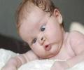 תמונות מצחיקות תינוק במצב פזילה